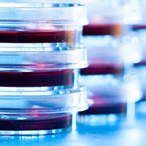 blood samples in petri dishes