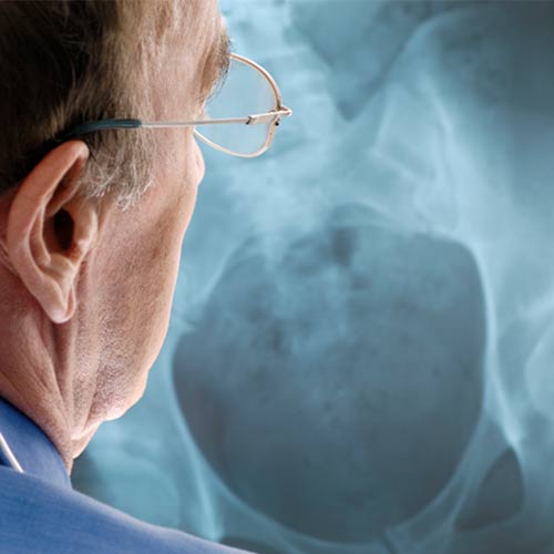 doctor looking at a bone xray