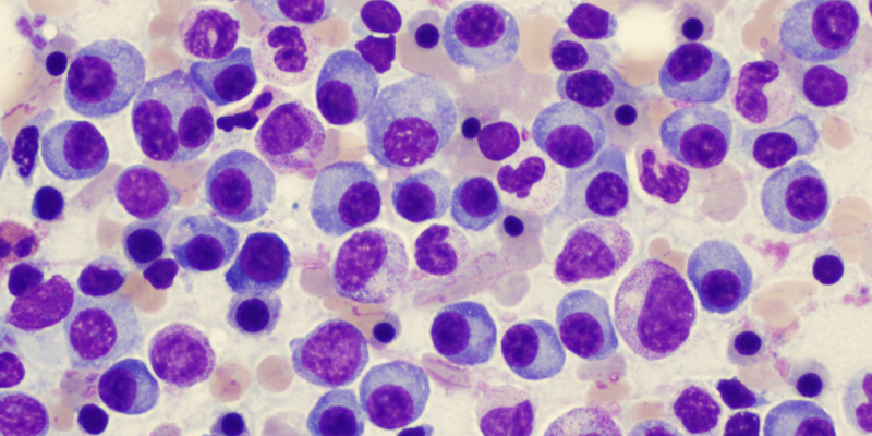 Myeloma Cells