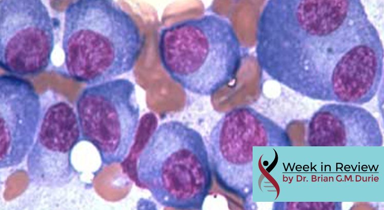 Multiple myeloma cells under microscope