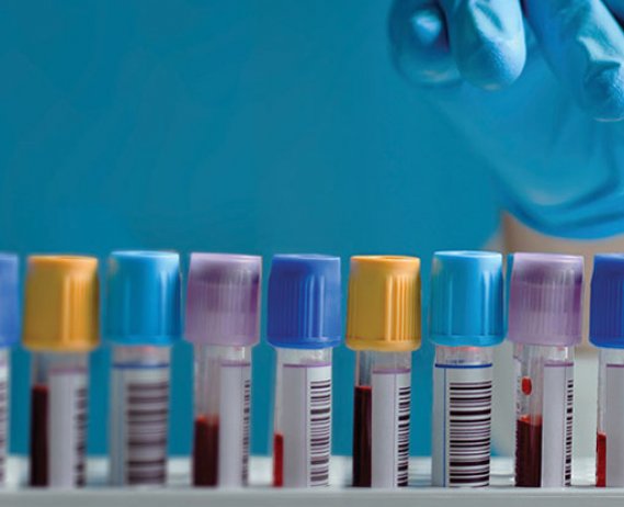 Prendendo alyri farmaci si puo prendere il cialis