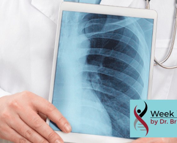 Doctor holds an Xray