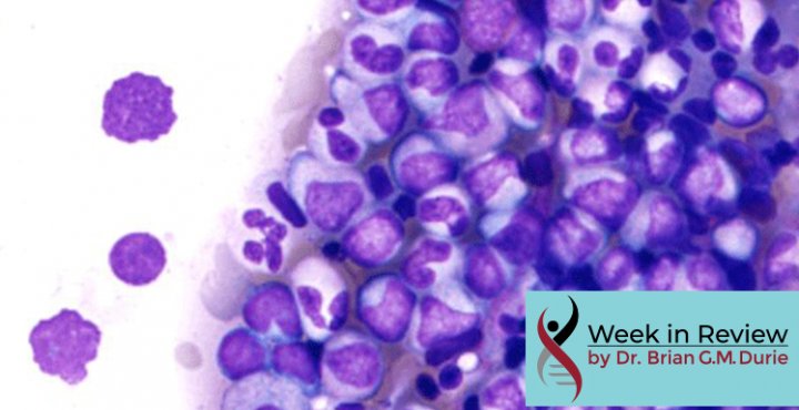 Myeloma Cells Under Microscope