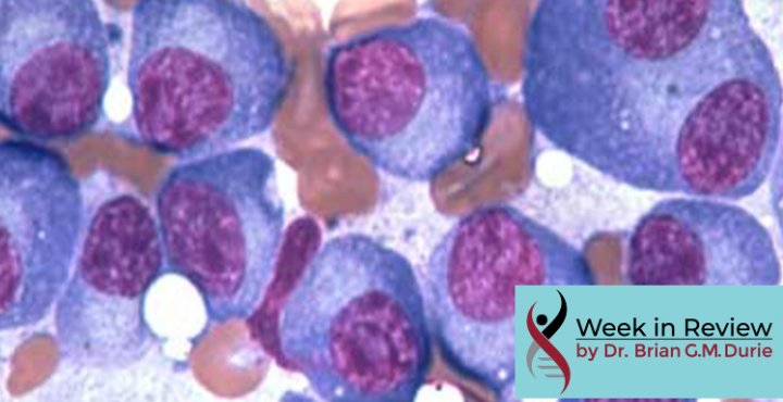 Multiple myeloma cells under microscope