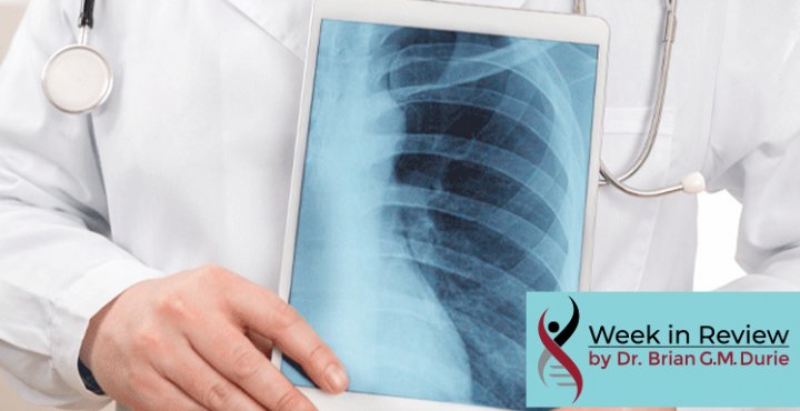 Doctor holds an Xray