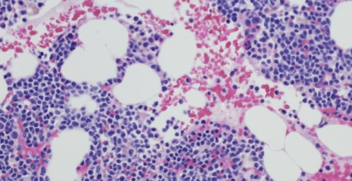 Cells magnified under a microscope.