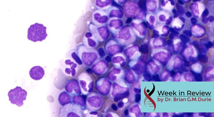 Myeloma Cells Under Microscope