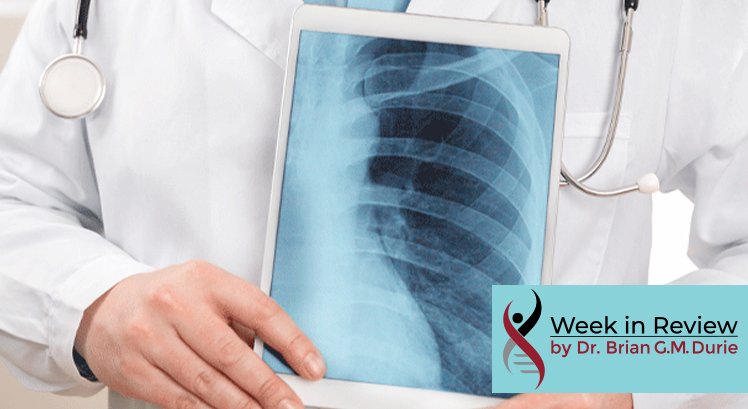 Doctor holds an Xray
