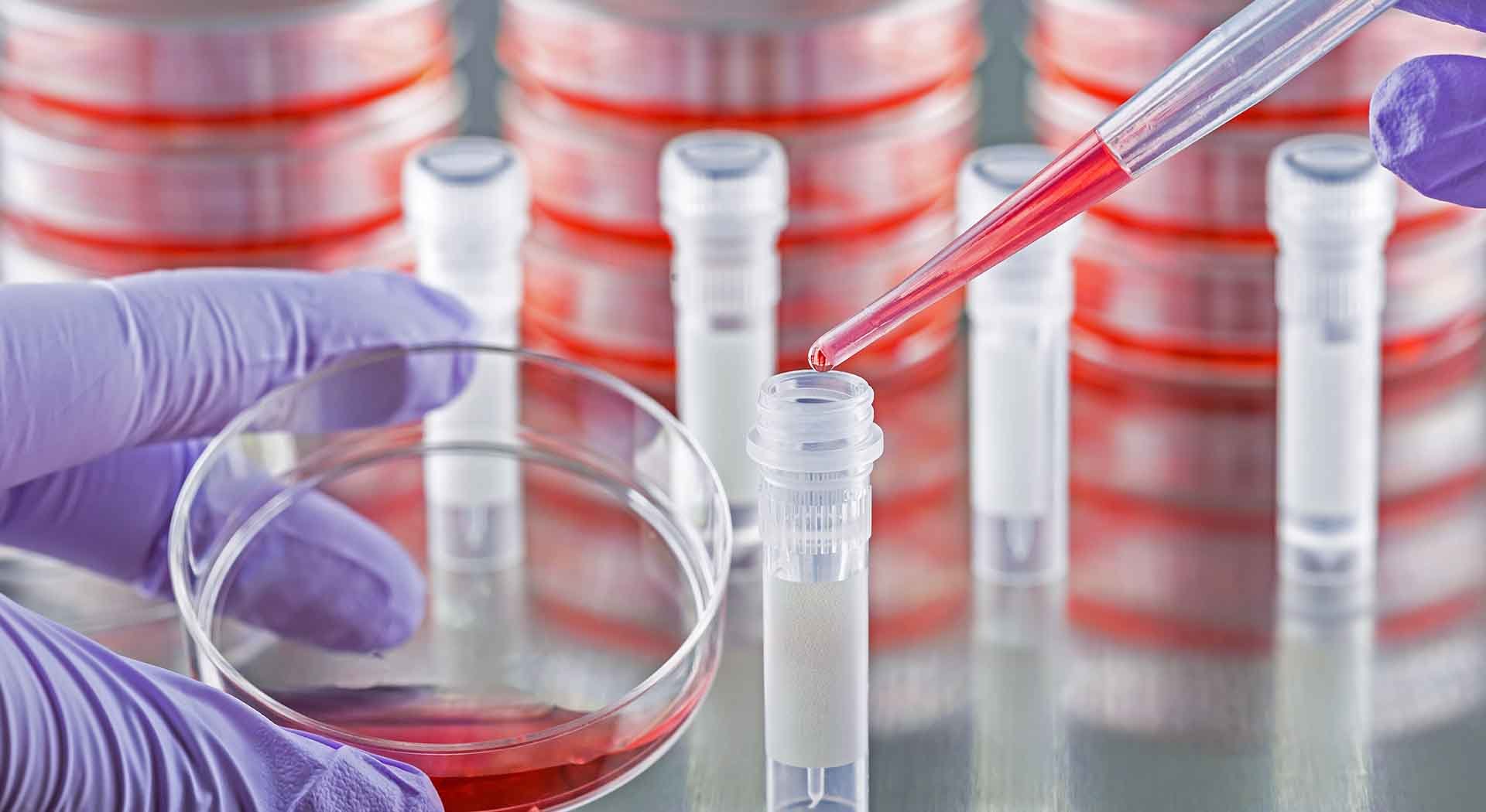 Closeup of scientist taking blood sample in lab