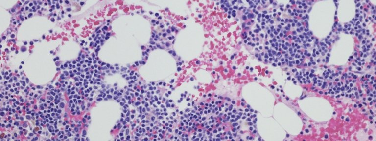 Cells magnified under a microscope.