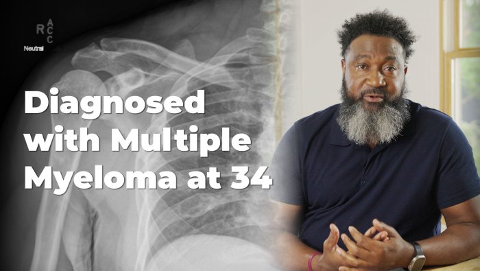 Thomas Goode Shares His Myeloma Story